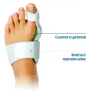 ATELLE HALUS VALGUS DROITE