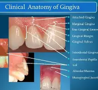 GINGIVAL